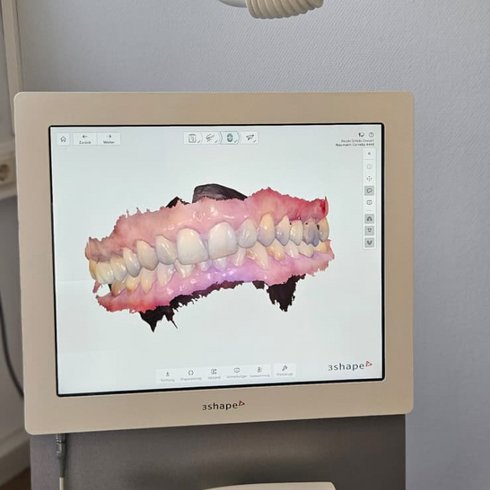 Intraoralscanner